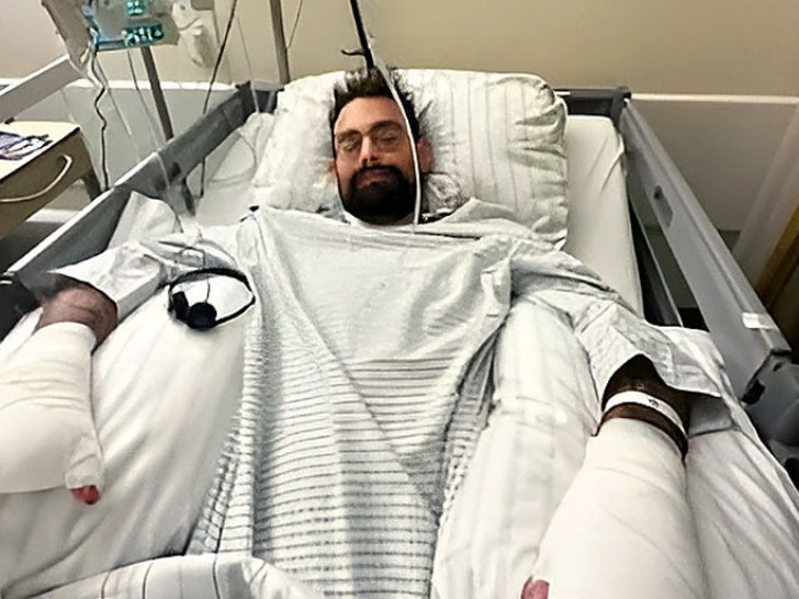 Otac petoro djece za jedan dan izgubio noge i prste: Sve je počelo tokom odmora