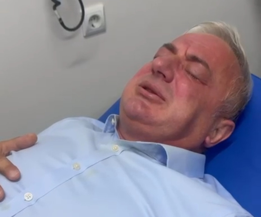 Dva maskirana muškarca napala Branislava Borenovića koji je prebačen u hitnu pomoć