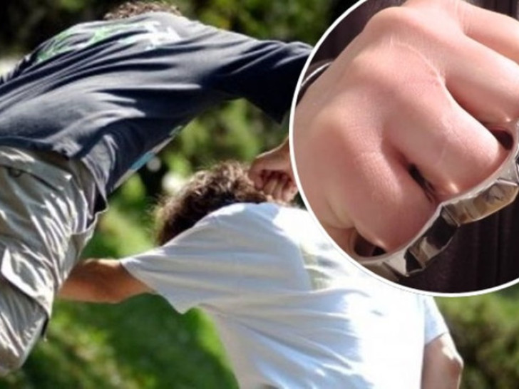 Banjaluka: Bokserom nokautirao drugog učenika, reagovala policija