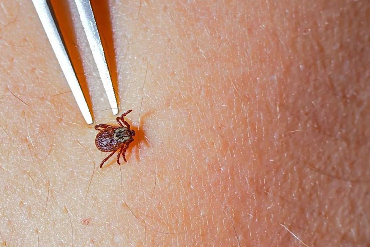 Najezda krpelja zabrinula građane, stručnjaci izdali važno upozorenje